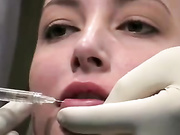 Увеличиваем губы препаратом Ювидерм