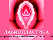 Интимный вопрос, связанный с лабиопластикой