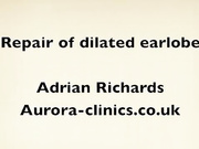 Как проводят коррекцию мочки уха