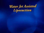 Методика водоструйной липосакции