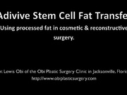 Липофилинг или работа с собственным жиром