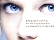 Всё о пластике век от "А" до "Я"