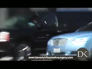 В каких случаях может понадобиться реконструкция груди