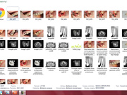Секреты стоматологии с доктором Самвелом Блея