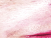 Применение артеколла