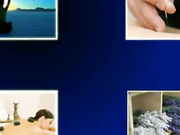 Диспорт - волшебные инъекции