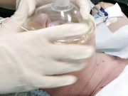 Операция груди