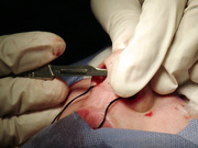 Операция Денисенко