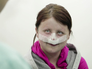 [Юлия Михейкина] Снятие швов