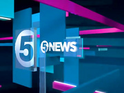 Эми Чайлдс сожалеет о пластике