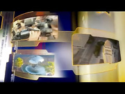 Kybella против двойного подбородка