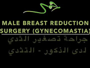 Гинекомастия - лечение за счет пластической операции