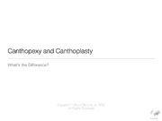 Кантопластика