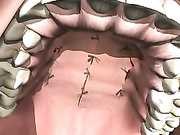 Коррекция волчьей пасти