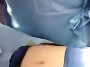 Коррекция пупка или умбиликопластика