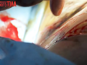 Я соромлюсь свого тіла- Выпуск 11 - Часть 2