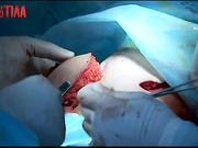 Успехи в лечении Татьяны Лапченко - Я соромлюсь свого тіла - Выпуск 2