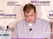 Пересадка лица подарила Патрику Хардисону новую жизнь