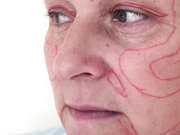 Історія_Лариси_Карапетян._Поверніть_мені_красу.mp4