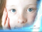 Как избавиться от пигментных пятен