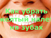 Желтый налет на зубах, домашний способ отбеливания зубов, способы отбеливания зубов